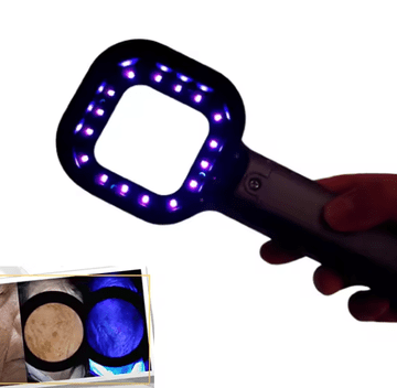 GLOBLIGHT Woodova UV svjetiljka za analizu kože i pigmentacije u kozmetičkim salonima