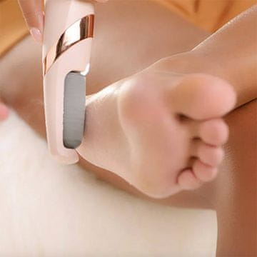 Netscroll Električna rašpa za pete, odstranjiva 2 valjka, električni odstranjivač tvrde kože, USB punjenje, LED svjetlo, kompaktan dizajn, Heely odstranjivač tvrde kože, Heely