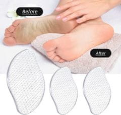 FRILLA® Staklena rašpa za stopala – pilica za glatke pete, suho i mokro korištenje | PEDIGLASS