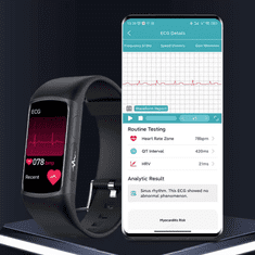 MXM Pametna narukvica s AMOLED zaslonom MF12-ECG - crna