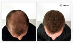 UVI Hair vlakna za kosu, MEDIUM BLONDE / Srednje plavuša (velika 27,5 g, do 50 nanosa)