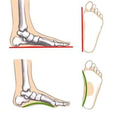 Netscroll Ortopedski ulošci za obuću za ravna/ploska stopala, 4D tehnologija potpore, unisex ulošci za udobnost i stabilnost, potpora stopalnom luku, protiv bolova u stopalima, InsolesFlat, 35/39