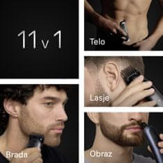 Braun AIO7540 11u1 urednik za lice i tijelo