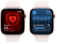 Apple Pametni sat serije 11, GPS, 42 mm, + remen S/M, bež (ružičasto zlato) (MEU04WF/A)
