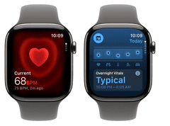 Apple Pametni sat Watch Series 11, GPS + Cellular, 42 mm + remen, M/L, titan (Prirodni titan) (MF8N4WF/A)