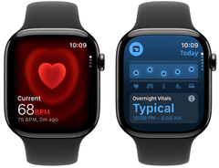Apple Pametni sat Watch Series 11, GPS + Cellular, 42 mm + S/M remen, titan (Slate Titanium) (MF8R4WF/A)