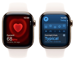 Apple Pametni sat Watch Series 11, GPS + Cellular, 42 mm + M/L remen, zlatno-titanijsko (MF8X4WF/A)