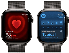 Apple Pametni sat Watch Series 11, GPS + Cellular, 42 mm + remen, S/M, boja Slate Milanese (MF8U4WF/A)