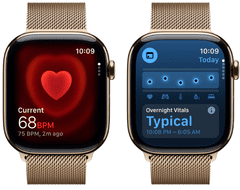 Apple Pametni sat serije 11, GPS + Cellular, 42 mm + remen, zlatni milanski (MF8Y4WF/A)