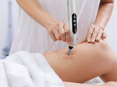 Verkgroup Punjiva akupunkturna masažna olovka elektrostimulator 5 vrhova LCD USB