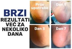 Orthexa Hidratantne čarape za pete - Heel