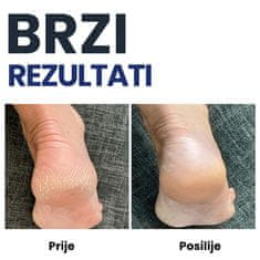 Orthexa Hidratantne čarape za pete - Heel