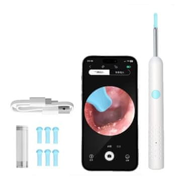 FRILLA® HD vizualni čistač ušiju 1080P, WiFi povezivanje, IPX5 vodootporan | EARSCAN