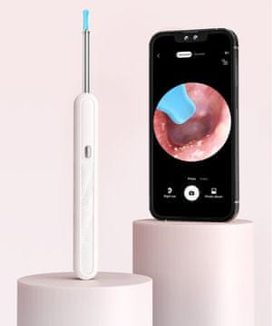 OTOSKOPSKI UREĐAJ ZA ČIŠĆENJE UŠIJU I UKLANJANJE VOSKA WIFI APLIKACIJA TELEFON ANDROID IOS LED 8MP