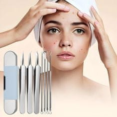 FRILLA® Alat za uklanjanje mitesera i prištića s kutijom, nehrđajući čelik | PORACLEAN