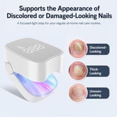 Netscroll Uređaj za njegu noktiju plavim svjetlom (460 nm), za liječenje gljivičnih infekcija, promijenjenih noktiju i zadebljanih noktiju, RepairNail.