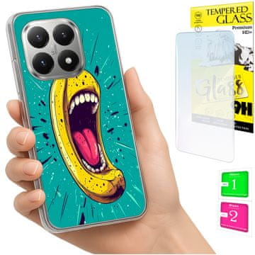 NEO Futrola za Xiaomi 15T FOTO Stražnja strana kućišta Grafika Banana + 9H STAKLO