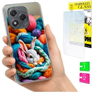 Etui za Honor 400 Lite obloga foto case poleđina grafika kunić + staklo 9h