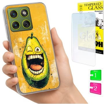 Etui za Motorola Edge 70, maska s foto kućištem, grafika avokado + staklo