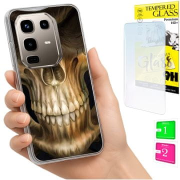 Etui za infinix note 50 pro 4g, fotografska maska, futrola + 9h staklo