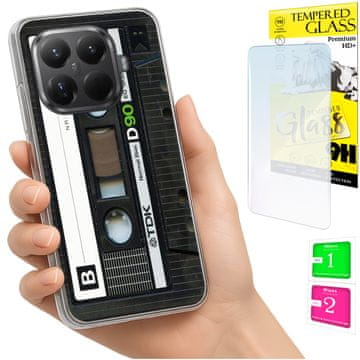 Etui za Xiaomi 15T Pro, fotografija, maska, futrola i staklo 9h