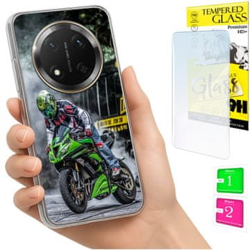 Fotokućište za Honor Magic7 Lite, maska sa stražnjom stranom i zaštitno staklo 9h