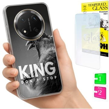 Torbica za Honor Magic7 Lite, foto maskica za leđa, futrola + 9H staklo