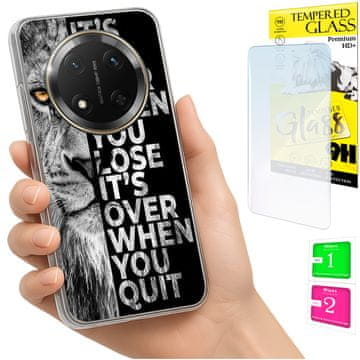 Etui za Honor Magic7 Lite, fotokućište, stražnja maska, futrola + 9H staklo
