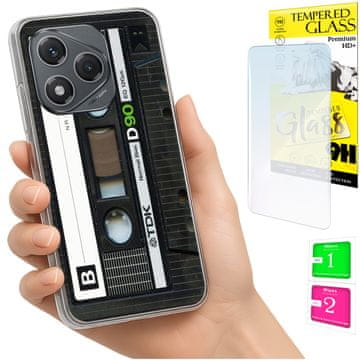 NEO Futrola za Honor 400 Lite FOTO stražnja maska ??+ 9H staklo