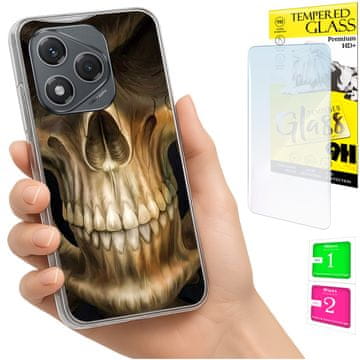 Fototorbica za Honor 400 Lite, maska s tvrdim leđima i zaštitnim staklom 9H