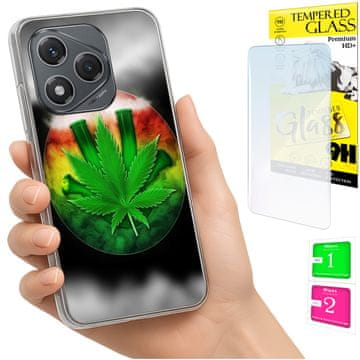 Fotoorbita za Honor 400 Lite, maska, stražnja strana, futrola, poklopac + staklo 9H