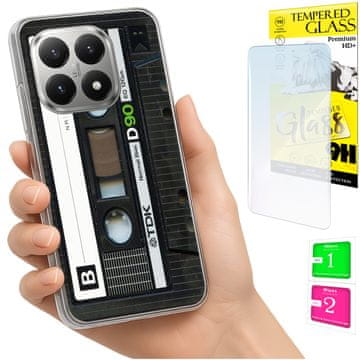 Etui za Xiaomi 15T fotokutija maskica za leđa + zaštitno staklo 9H