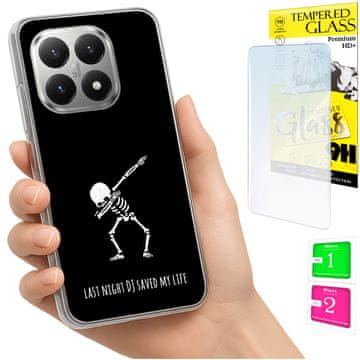 Etui za Xiaomi 15T, foto maskica za leđa + staklo 9H