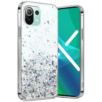 GS Maska za Xiaomi Mi 11 Lite / Mi 11 Lite 5G / 11 Lite 5G NE, svjetlucava, prozirna