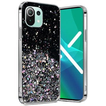 GS Futrola za Xiaomi Mi 11 Lite / Mi 11 Lite 5G / 11 Lite 5G NE, svjetlucava, crna