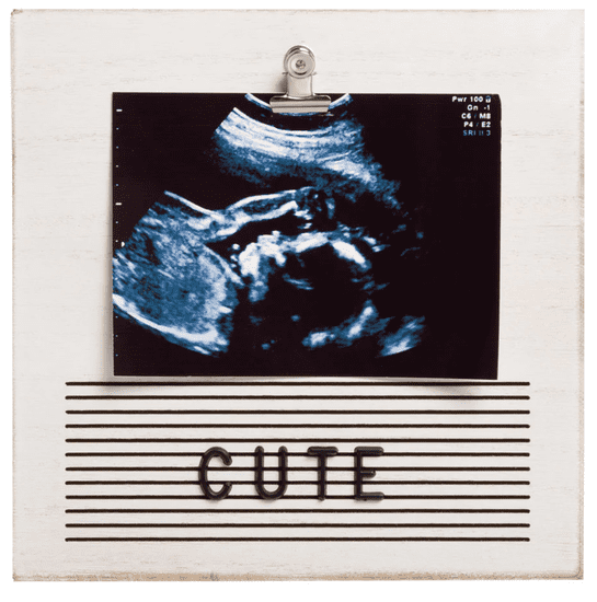 Pearhead Letter Board i Sonogram okvir
