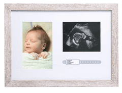 Pearhead rustikalni okvir - slika, sonogram i narukvica za identifikaciju rođenja