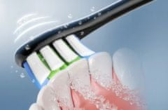 Oclean X10 električna sonična četkica za zube, roza