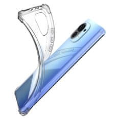 MG Anti Shock Military silikonska maska za Xiaomi Mi 11, proziran